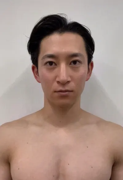 LIF Shock 施術前